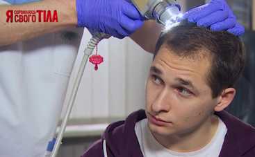 Борьба с выпадением волос: результаты эксперимента Я соромлюсь свого тіла