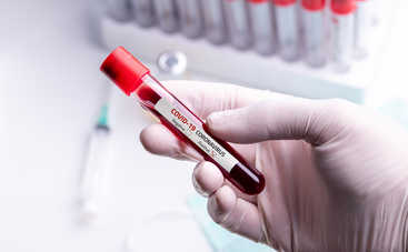 Медики назвали болезнь, которая существенно увеличивает риск смерти от вируса COVID-19