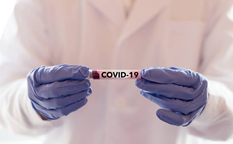 В ВОЗ назвали сроки завершения пандемии COVID-19