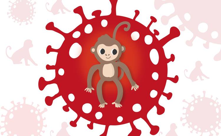 Віспа мавп: як поширюється, симптоми, перебіг захворювання, лікування, заходи профілактики