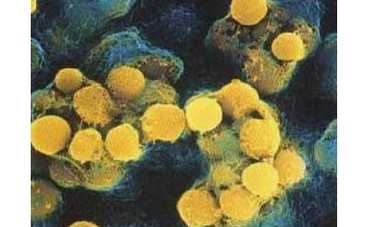 Первый канал покажет документальный фильм "Плесень"