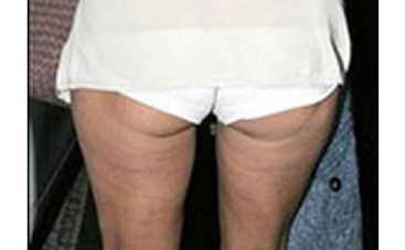 Ягодицы Памелы Андерсон вновь попали в объектив