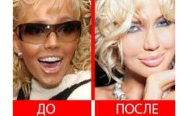Маша Малиновская сделала пластическую операцию