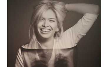 Вера Брежнева борется с туберкулезом