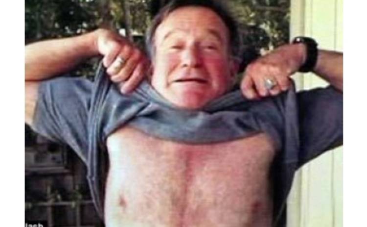 Робин Уильямс показал ужасные шрамы на груди