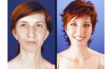 Умерла участница "Фабрики красоты"