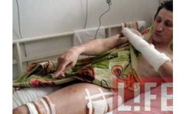 Сбитый Сукачевым пешеход выходит из больницы