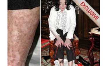 Медсестра Джексона: Майкл проводил в наркотическом сне до 72 часов