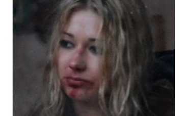 "Ранетку" Леру жестоко избили десять киевских подростков [ФОТО]