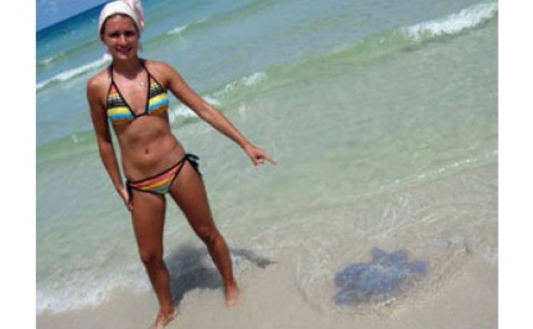 Солнце укусила ядовитая медуза