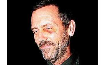 "Доктора Хауса" избили боксеры