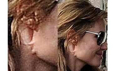 Анджелина Джоли изуродовала себя пластической хирургией