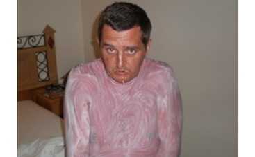 Дядя Жора получил солнечный удар