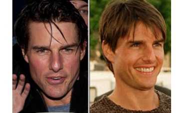 Том Круз делает уколы ботокса