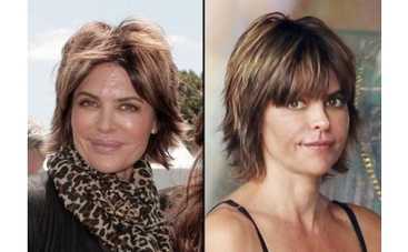 Звезда "Района Мелроуз" лишилась губ