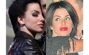 Юля Волкова избавилась от силикона