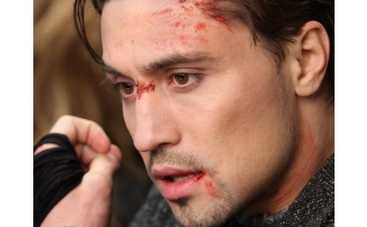 Диму Билана избили