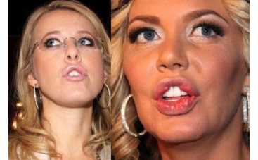 Ксения Собчак испортила губы ФОТО