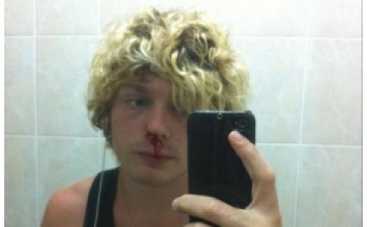 Александр Кривошапко избили?