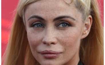 Звезду фильма Миссия невыполнима изуродовали хирурги