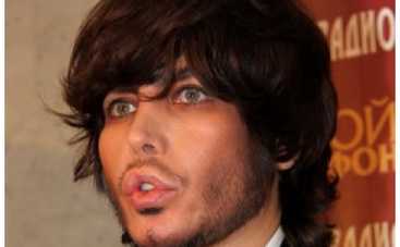 У Сергея Зверева после пластики не закрывается рот