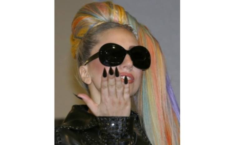Леди Гага про операцию: в бедре была огромная дыра