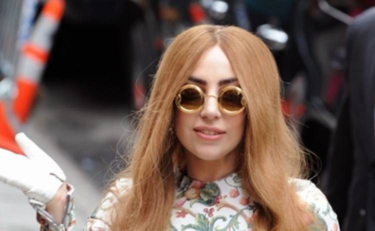 Леди Гага показала фото с залысинами на лбу (ФОТО)