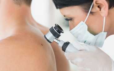 Родинки летом становятся опасными