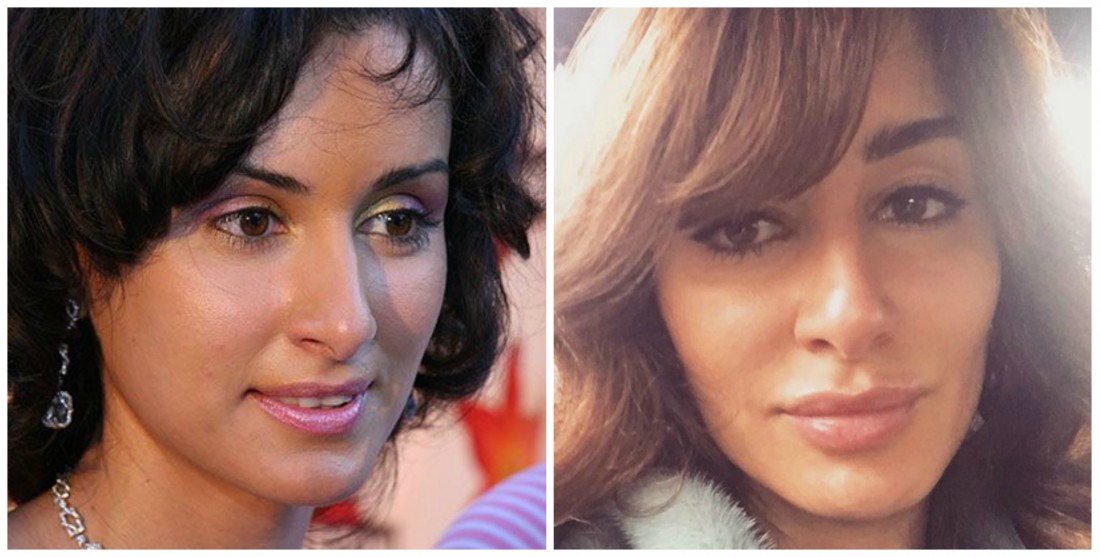 Фото Тины Канделаки “до“ и “после“ изменений во внешности 