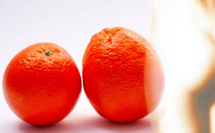 Апельсиновая корка. Правда и домыслы о целлюлите