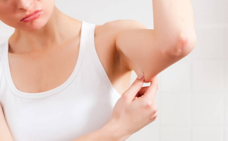 5 способов «сбросить» лишнюю кожу после похудения