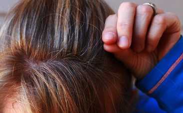 Рано седеют волосы: причины и методы борьбы с сединой