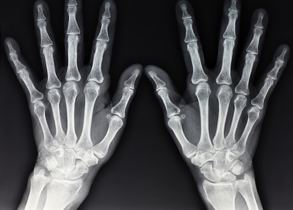 x-ray-hands