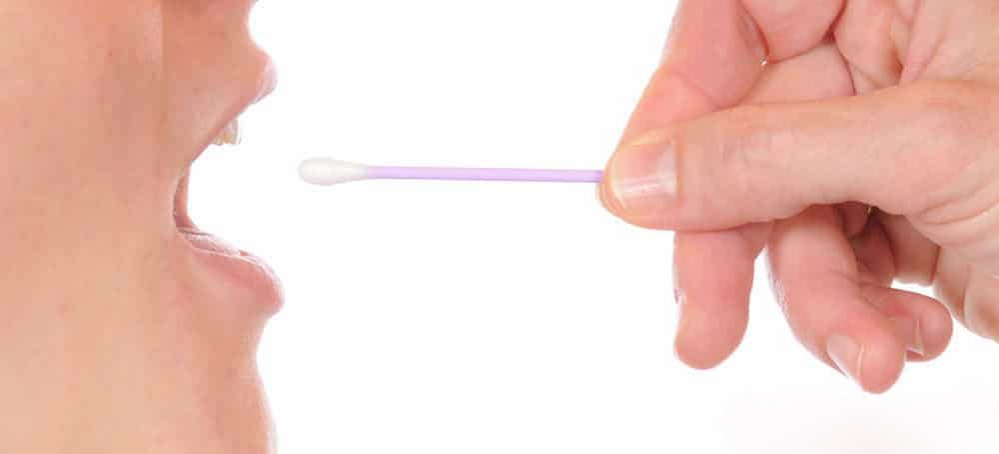 buccal-swab-collection_01